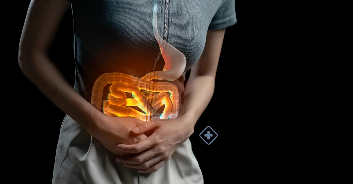 Diverticulitis